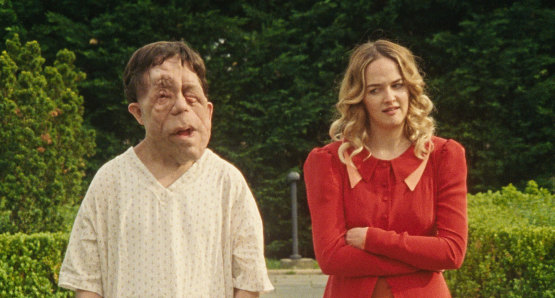 Adam Pearson and Jess Weixler in a scene from <i>Chained for Life</i>, courtesy Kino Lorber