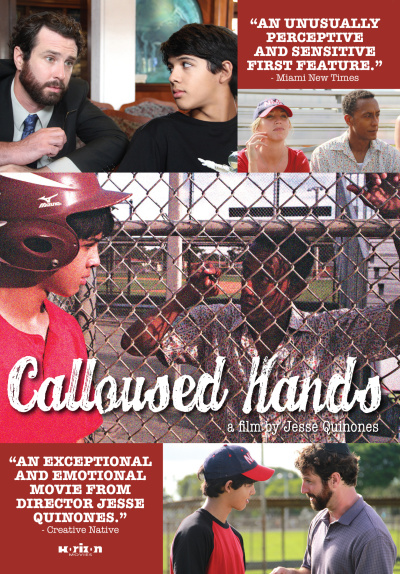 Calloused Hands