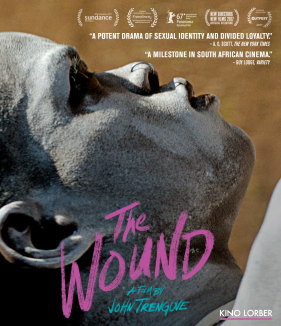 The Wound